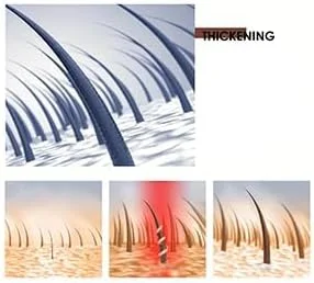 شامپو بار آب برنج TERRIFI برای رشد مو، شامپو بار کیتچ، نرم کننده جامد کاملا طبیعی برای موهای نازک و جلوگیری از ریزش مو، فرمول مغذی برای موهای قوی تر و سالم تر