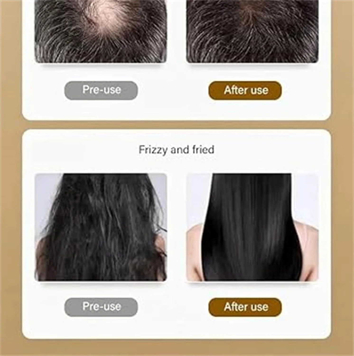 شامپو جینسینگ، شامپو مغذی ریشه عصاره جینسینگ، شامپو مغذی جینسینگ، شامپو ضد ریزش مو، شامپو ضخیم کننده مو برای موهای قوی تر، ضخیم تر و بلندتر (2 عدد) شامپو جینسینگ، شامپو مغذی ریشه عصاره جینسینگ، شامپو مغذی جینسینگ، شامپو ضد ریزش مو، شامپو ضخیم کننده مو برای موهای قوی تر، ضخیم تر و بلندتر (2 عدد)