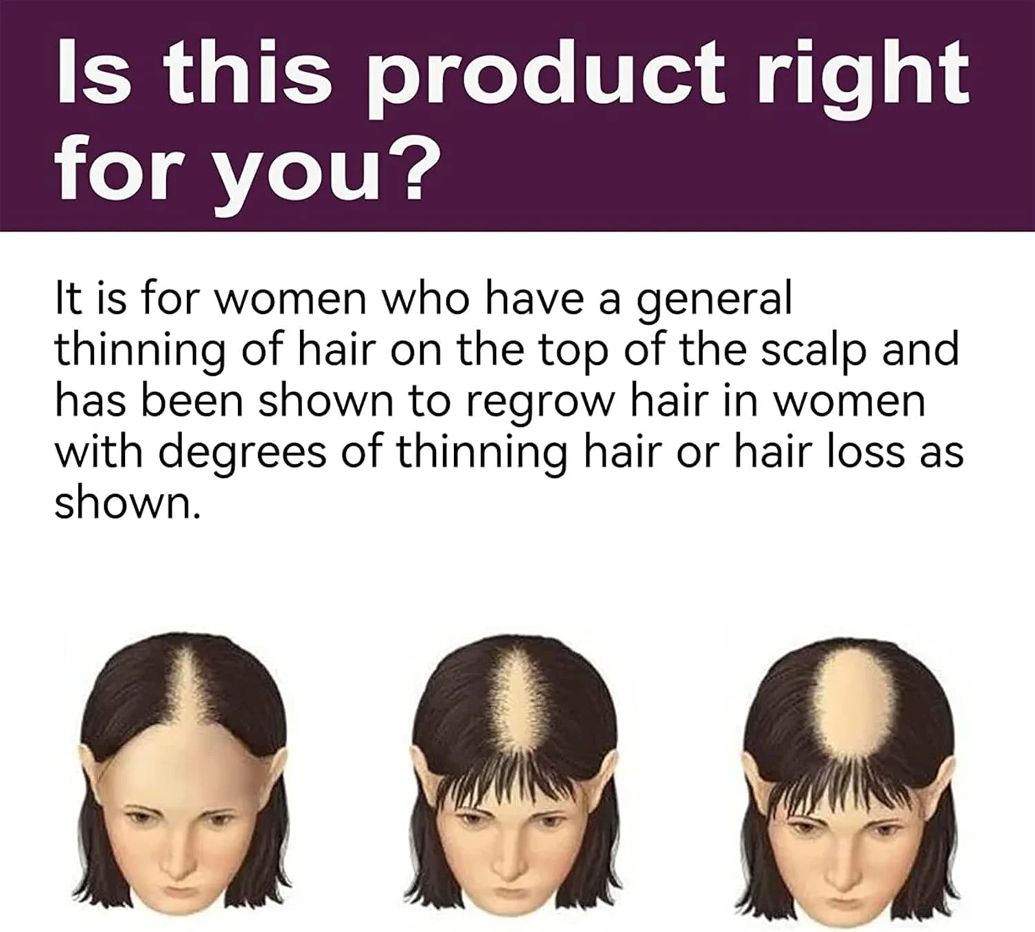 شامپو فوم احیا کننده مو KERA'GRO، شامپو رشد مو بیوتین و کلاژن، شامپو ضخیم کننده رشد مو، درمان ضد ریزش مو برای موهای نازک (1 ست)