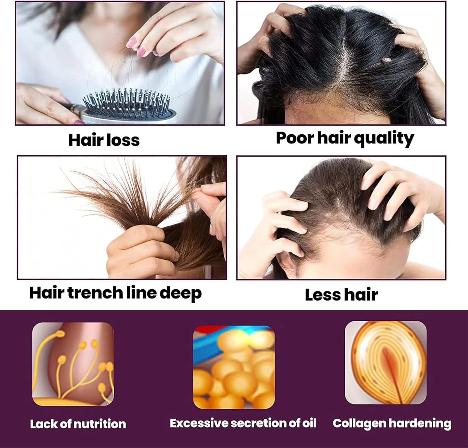 شامپو فوم احیا کننده مو KERA'GRO، شامپو رشد مو بیوتین و کلاژن، شامپو ضخیم کننده رشد مو، درمان ضد ریزش مو برای موهای نازک (1 ست)