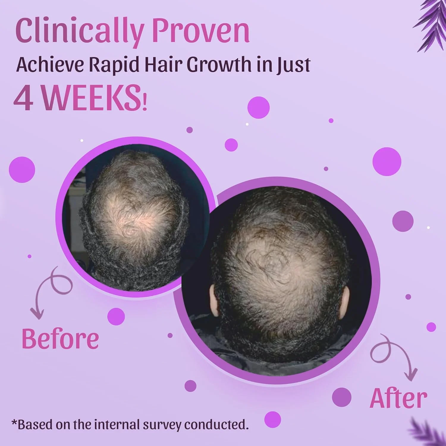 شامپو ضد ریزش مو رزماری نیمسون با رزماری و شنبلیله - کاهش ریزش و شکستگی مو، تغذیه کننده مو، پاکسازی عمیق، مناسب برای آقایان و بانوان (250 میلی لیتر)