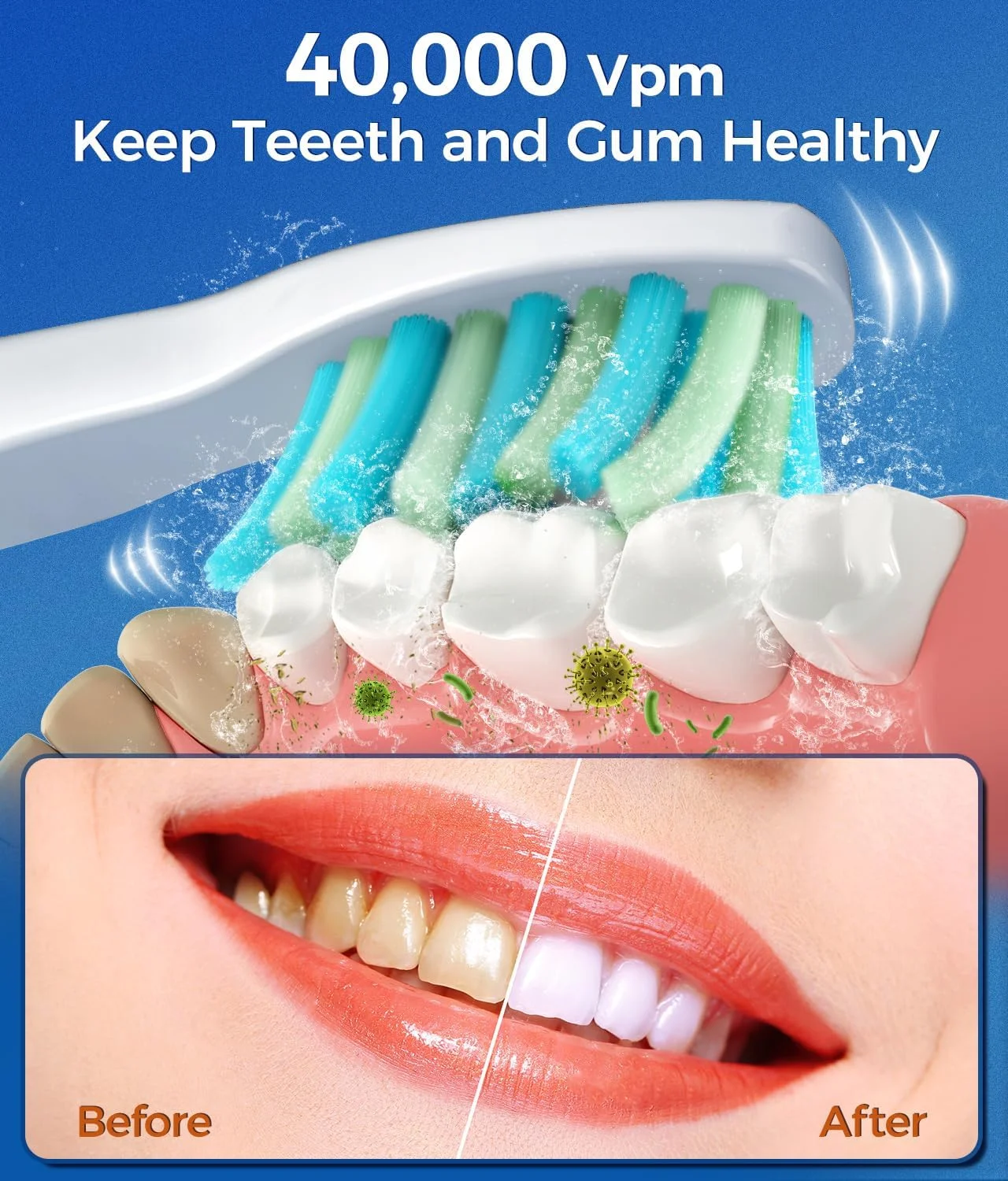 سری یدک مسواک TEETHEORY، بسته 6 عددی، سری یدک مسواک برقی، نظافت آسان، مناسب برای سلامت لثه (سفید، 6 عدد)