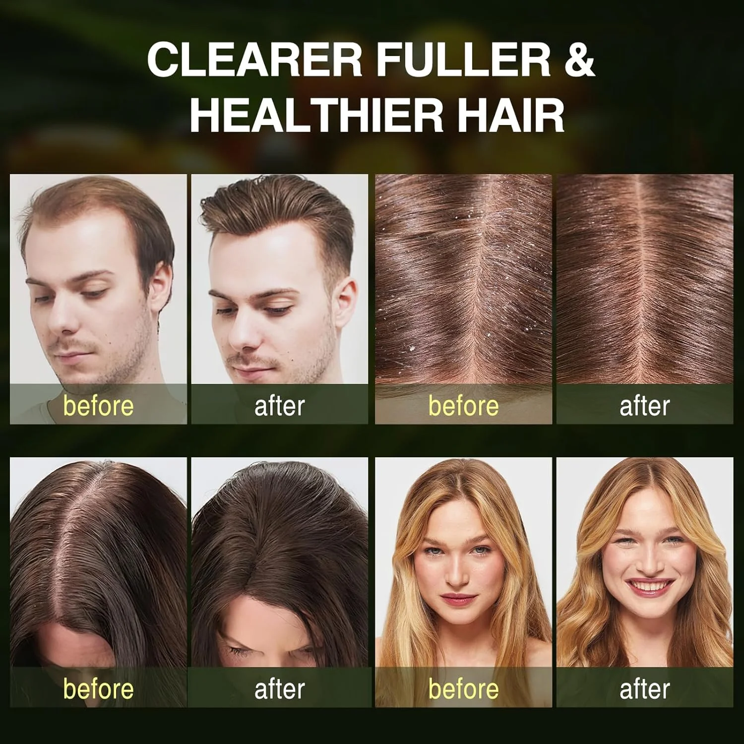 شامپو روغن باتانا برای رشد مو، شامپو تقویت کننده رشد مجدد مو برای مردان و زنان با موهای نازک و ریزش مو، غنی شده با رزماری و روغن نعناع، تغذیه کننده پوست سر، بدون سولفات برای انواع مو، 300 میلی لیتر