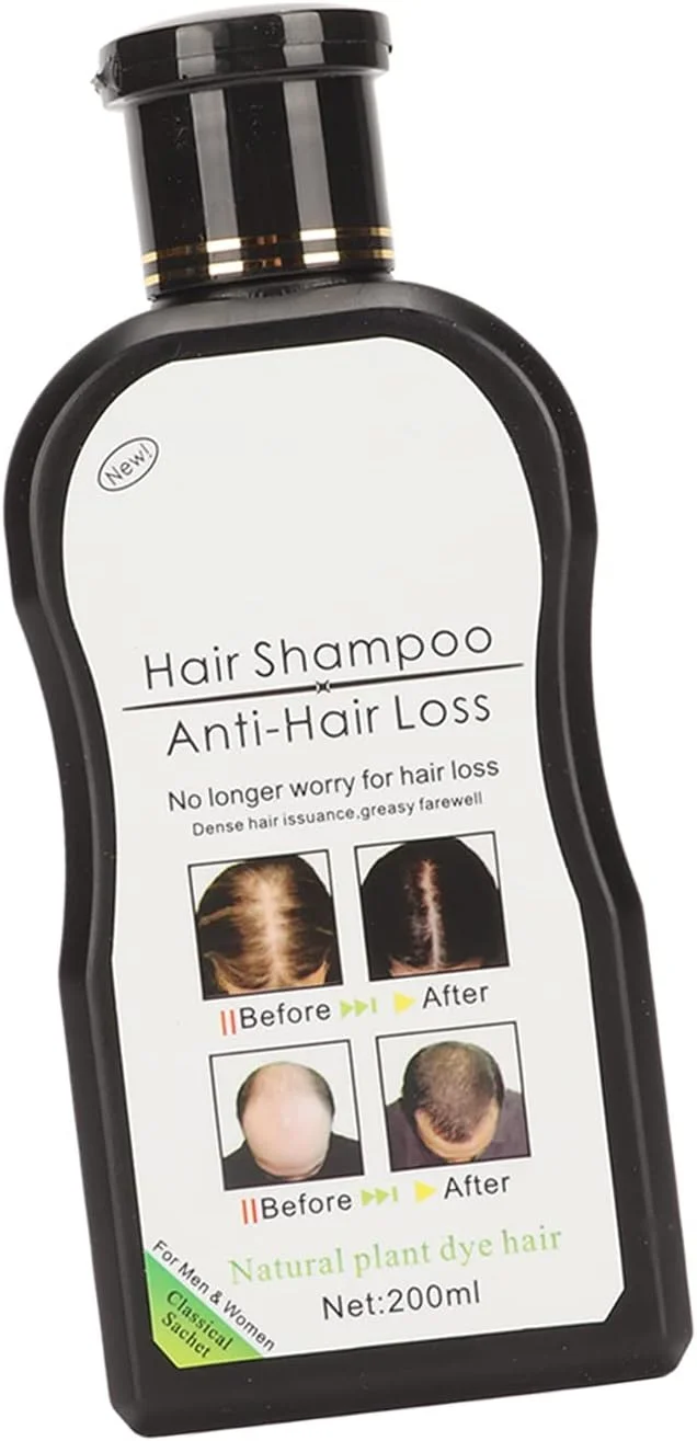 شامپو رشد مو، شامپو حجم دهنده مو جلوگیری از ریزش مو با حجم 200 میلی لیتر، تقویت کننده ریشه مو برای استفاده خانگی، مناسب برای انواع مو