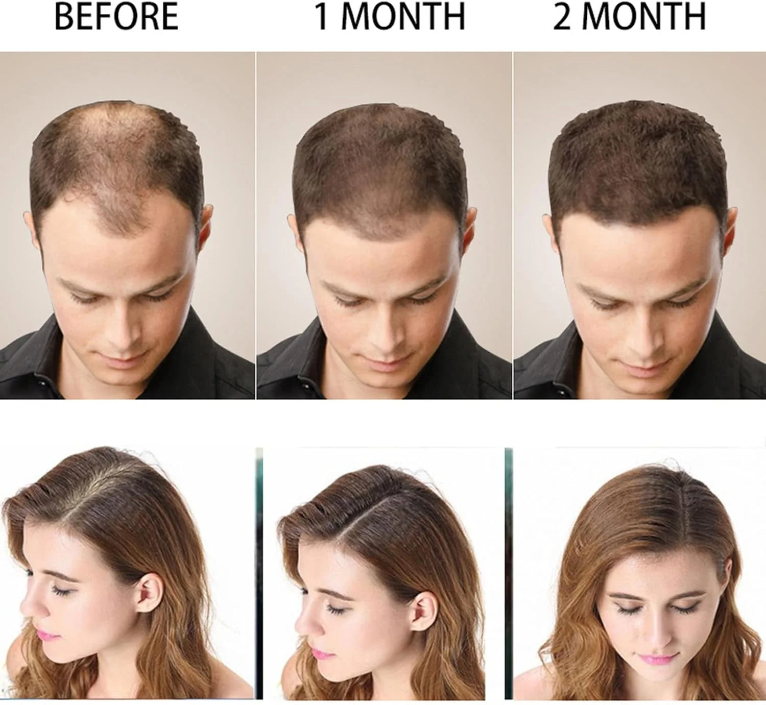 شامپو رشد مو، شامپو حجم دهنده مو جلوگیری از ریزش مو با حجم 200 میلی لیتر، تقویت کننده ریشه مو برای استفاده خانگی، مناسب برای انواع مو