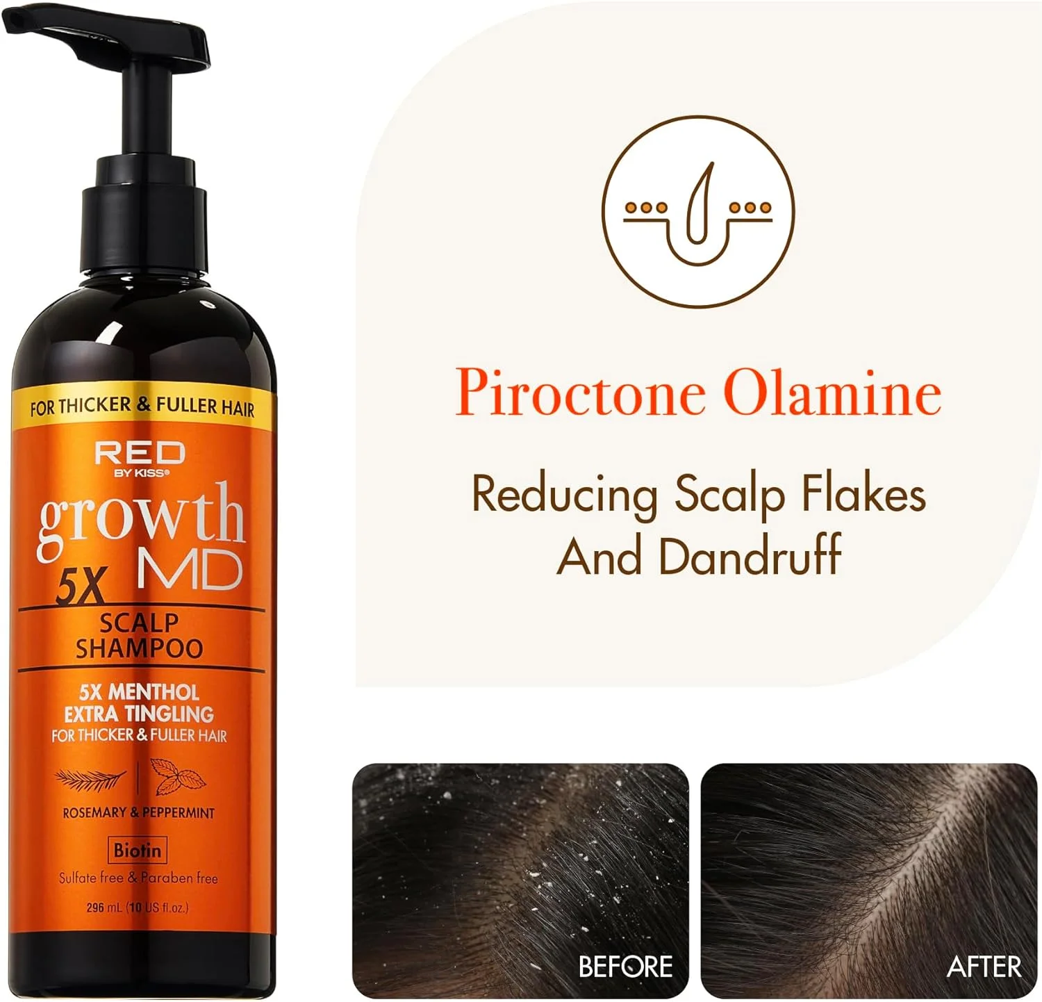 شامپو سر رِد بای کیس Growth MD، منتول 5X با حس خنکی فوق العاده برای موهای ضخیم تر و پرپشت تر، غنی شده با ویتامین ها و بیوتین برای تقویت و تسکین خارش، فرمول وگان و بدون تست حیوانی (295 میلی لیتر)