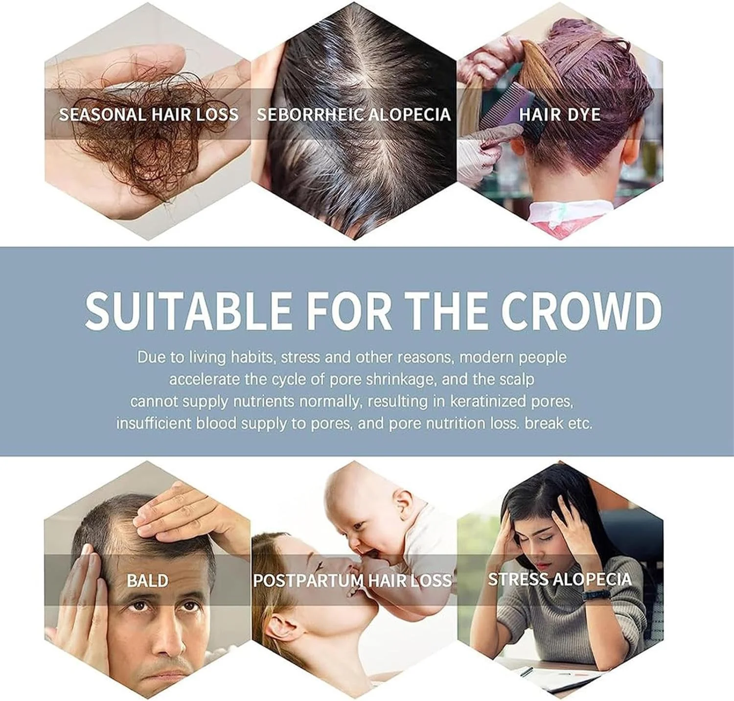 شامپو و نرم کننده ژاپنی ساکورا 300 میلی لیتر | شامپو مغذی پوست سر برای ضخیم کردن موهای خشک و آسیب دیده شامپو و نرم کننده ژاپنی ساکورا 300 میلی لیتر | شامپو مغذی پوست سر برای ضخیم کردن موهای خشک و آسیب دیده