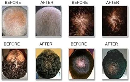 نرم کننده ضخیم کننده مو ریوایوژن پرو، نرم کننده برای موهای نازک، نرم کننده ضد ریزش مو، نرم کننده ضخیم کننده مو مردانه/زنانه، نرم کننده برای ریزش مو، 236 میلی لیتر نرم کننده ضخیم کننده مو ریوایوژن پرو، نرم کننده برای موهای نازک، نرم کننده ضد ریزش مو، نرم کننده ضخیم کننده مو مردانه/زنانه، نرم کننده برای ریزش مو، 236 میلی لیتر