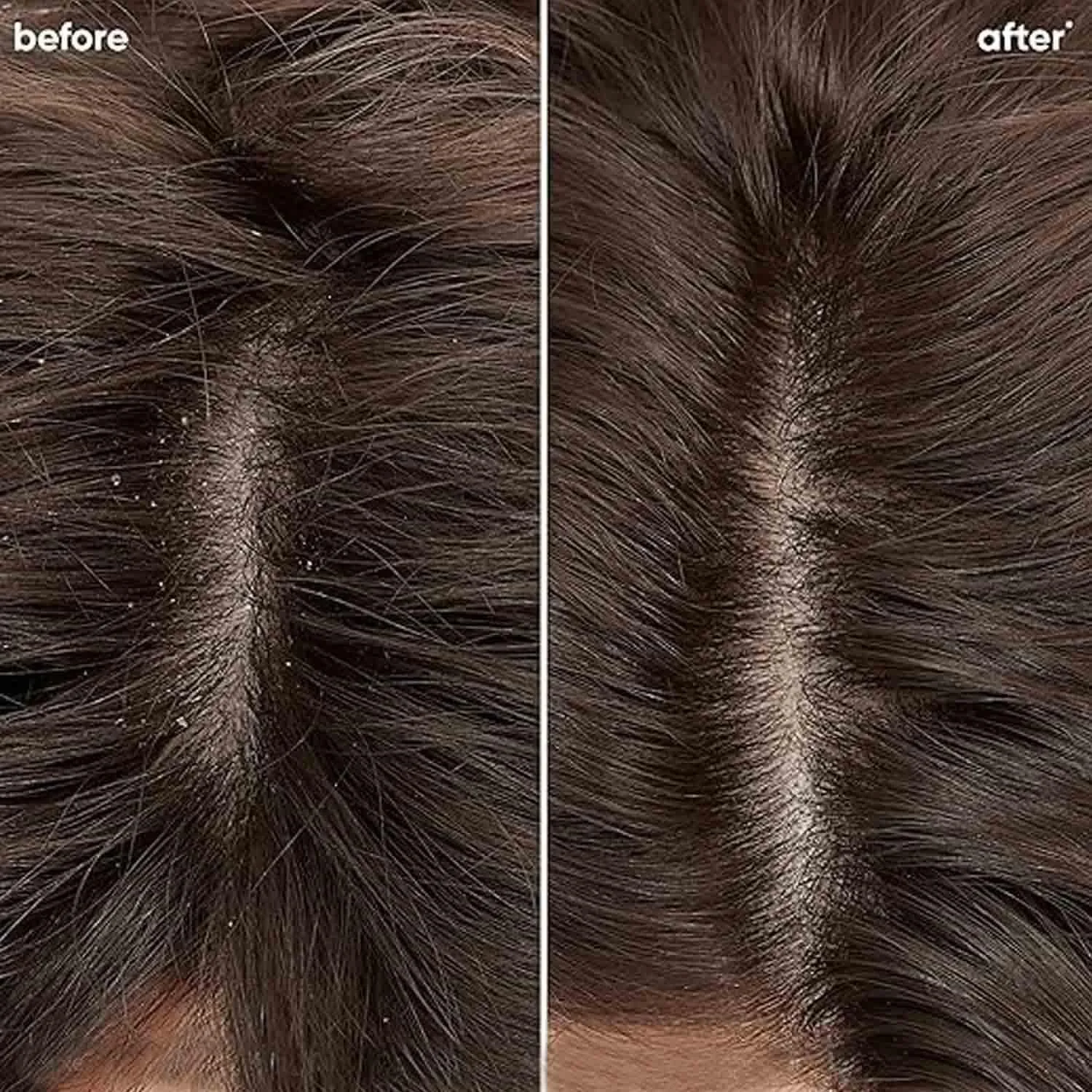 نرم کننده موی سر MATRIX by FBB Biolage Scalp Pure Complete Solution، 98 گرم نرم کننده موی سر MATRIX by FBB Biolage Scalp Pure Complete Solution، 98 گرم
