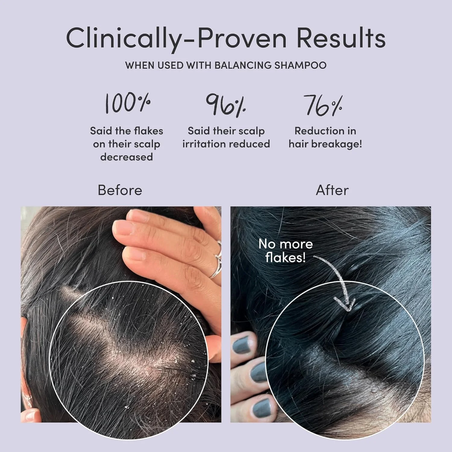 نرم کننده متعادل کننده پوست سر ژوپیتر، فرموله شده توسط پزشک، برای پوست سر خشک، خارش دار، چرب و پوسته پوسته، بدون سولفات، رایحه طبیعی - وگان - نرم کننده بدون پارابن و ایمن برای رنگ مو برای زنان و مردان نرم کننده متعادل کننده پوست سر ژوپیتر، فرموله شده توسط پزشک، برای پوست سر خشک، خارش دار، چرب و پوسته پوسته، بدون سولفات، رایحه طبیعی - وگان - نرم کننده بدون پارابن و ایمن برای رنگ مو برای زنان و مردان