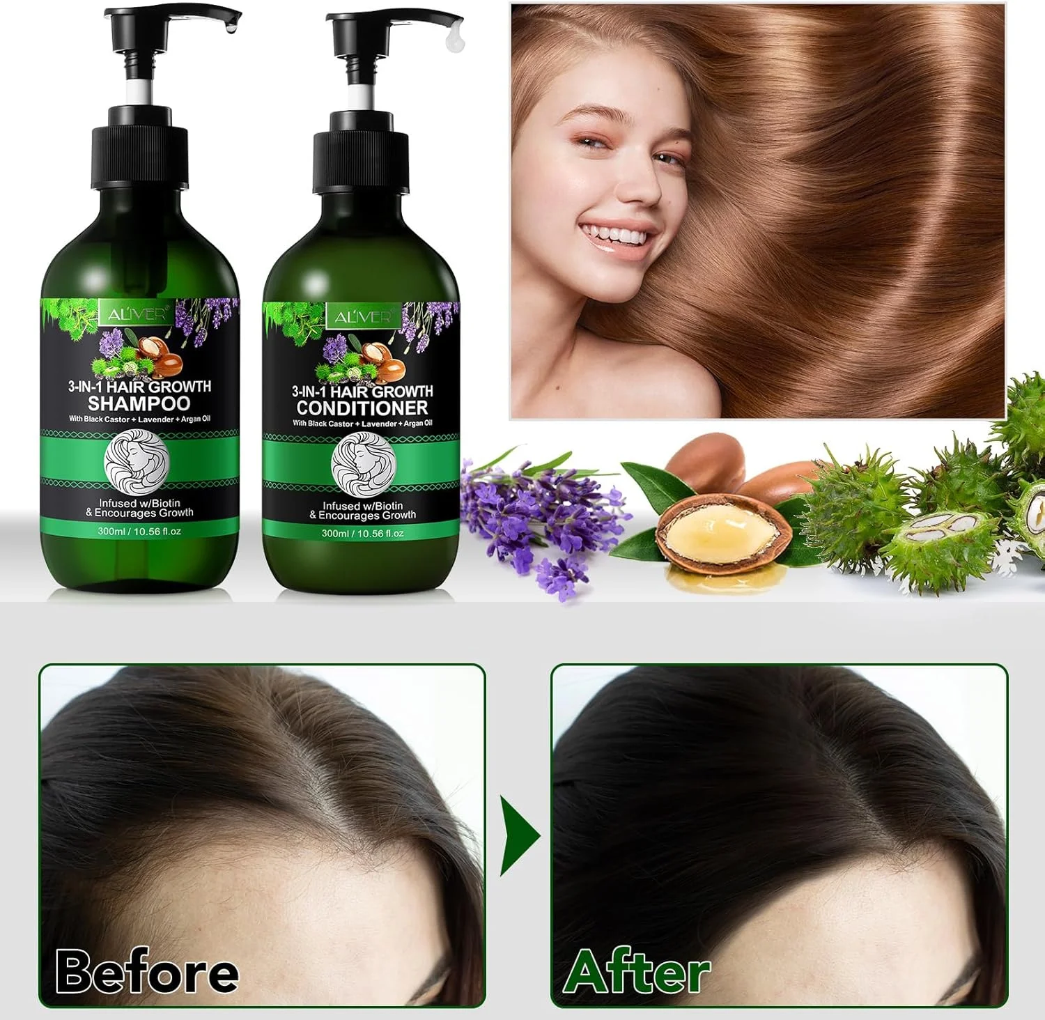 شامپو و نرم کننده بیوتین روغن کرچک سیاه برای رشد مو 300 میلی لیتر، مرطوب کننده، تقویت کننده و ضخیم کننده مو، ضد شوره