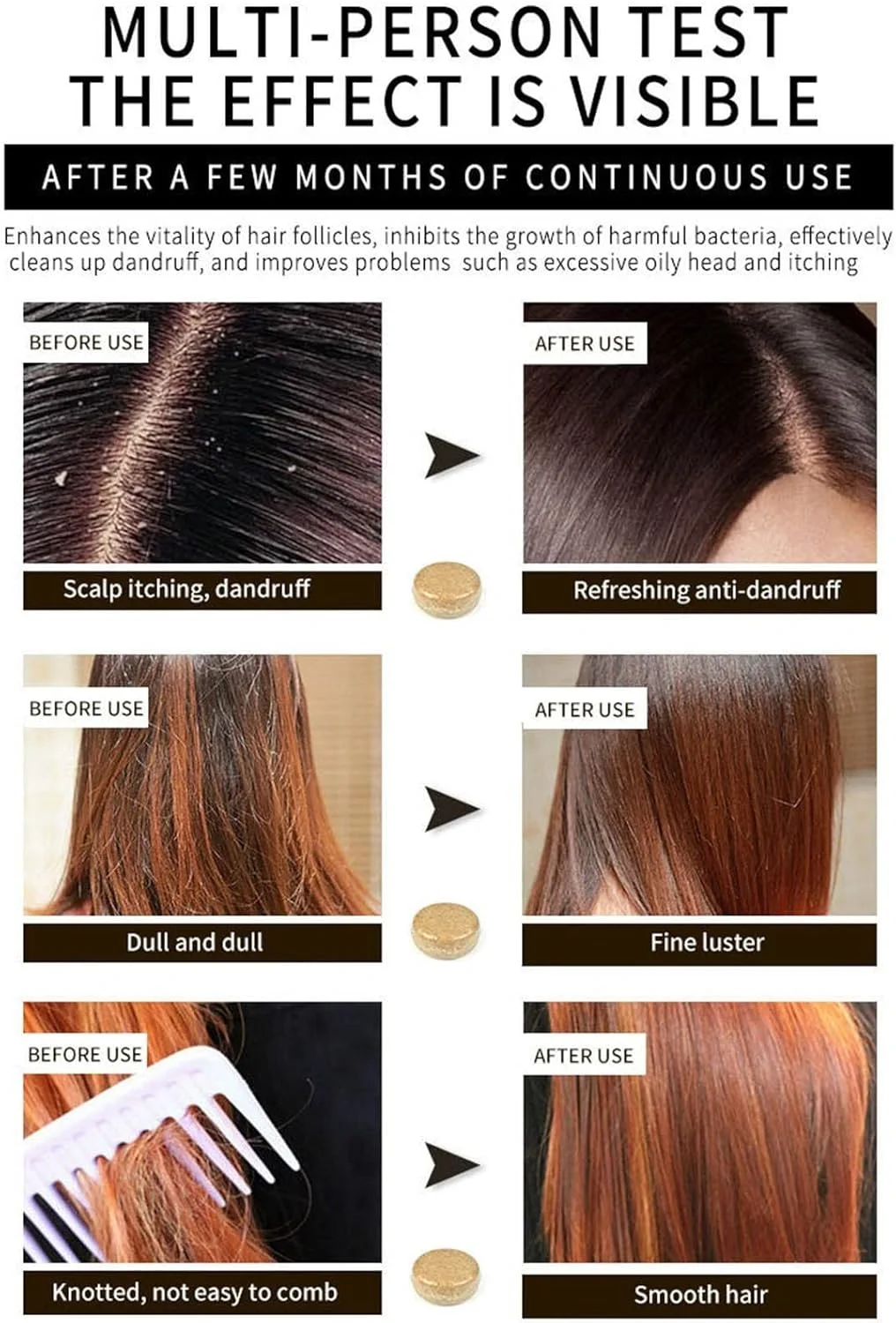 شامپو بار زنجبیلی برای رشد مجدد مو، شامپو بار زنجبیلی ارگانیک طبیعی، تقویت کننده رشد مو، تغذیه و مرطوب کننده مو، ترمیم کننده مو، ضد شوره و ضد خارش، برای آقایان و بانوان (2 عدد) شامپو بار زنجبیلی برای رشد مجدد مو، شامپو بار زنجبیلی ارگانیک طبیعی، تقویت کننده رشد مو، تغذیه و مرطوب کننده مو، ترمیم کننده مو، ضد شوره و ضد خارش، برای آقایان و بانوان (2 عدد)