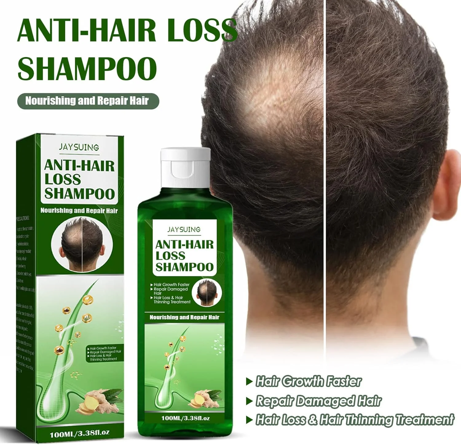 شامپو زنجبیل 100 میلی لیتری 2 عددی، شامپو رشد مجدد مو زنجبیل برای ضد ریزش مو، تغذیه کننده پوست سر، رفع شوره سر، تسکین خارش، شامپو کنترل چربی