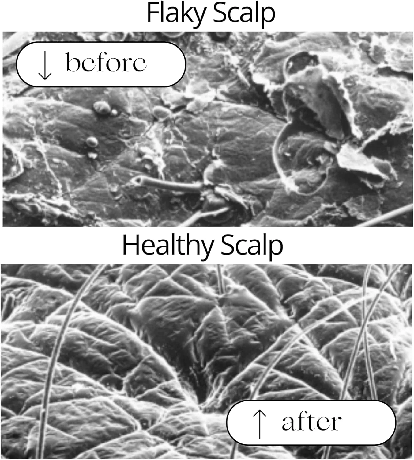 شامپو ضد شوره توسیلگو راوش 200 میلی لیتر شامپو ضد شوره توسیلگو راوش 200 میلی لیتر