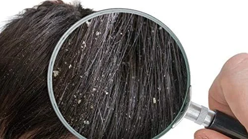 شامپو ضد شوره سر Oilatum (بسته 2 عددی) شامپو ضد شوره سر Oilatum (بسته 2 عددی)