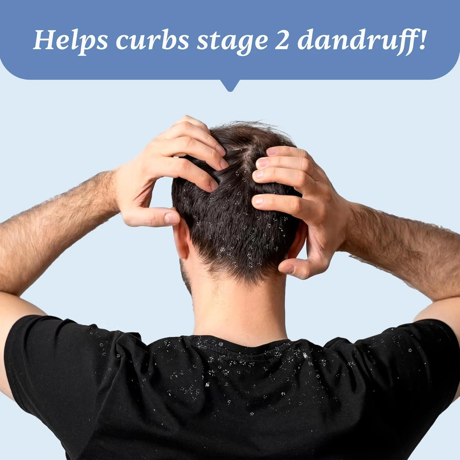 شامپو ضد شوره سر آقایان Man Matters حجم 100 میلی لیتر و لوسیون رفع شوره سر 60 میلی لیتر | از بین برنده شوره های شدید، کاهش دهنده پوسته ریزی و تسکین دهنده خارش پوست سر | کیت رفع شوره سر برای شوره سر مرحله 2 شامپو ضد شوره سر آقایان Man Matters حجم 100 میلی لیتر و لوسیون رفع شوره سر 60 میلی لیتر | از بین برنده شوره های شدید، کاهش دهنده پوسته ریزی و تسکین دهنده خارش پوست سر | کیت رفع شوره سر برای شوره سر مرحله 2