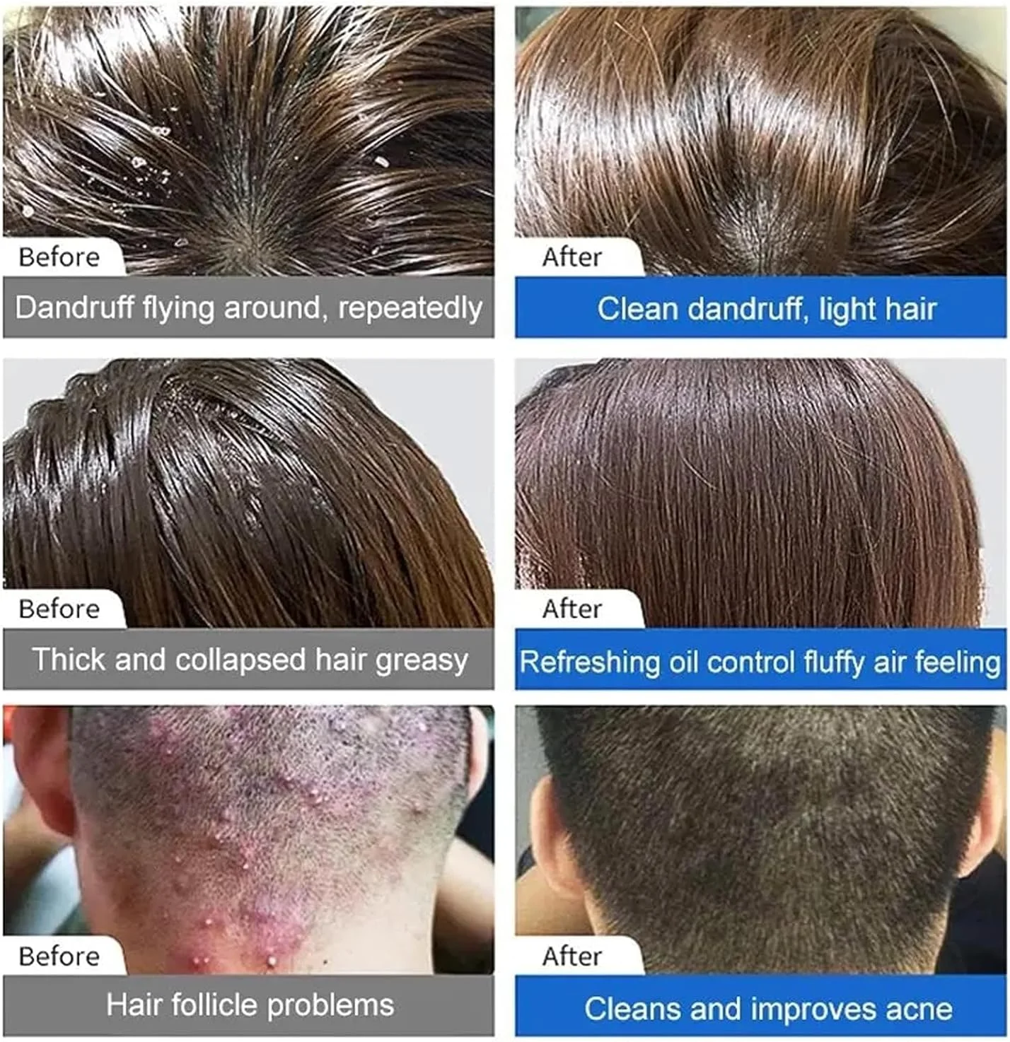 شامپو سر جدید Maigoole مدل 2023، نرم کننده آرتمیزیا ضد شوره، شامپو ضد شوره سر ژاپنی، پاک کننده عمیق پوست سر، کنترل کننده چربی و طراوت بخش برای آقایان و بانوان (3 عدد)