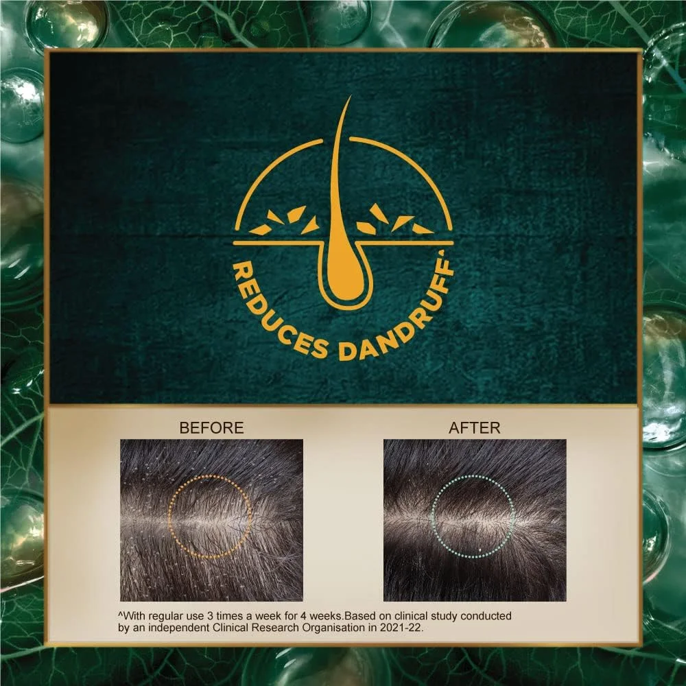 شامپو ضد شوره ایندولهکا 340 میلی لیتر شامپو ضد شوره ایندولهکا 340 میلی لیتر