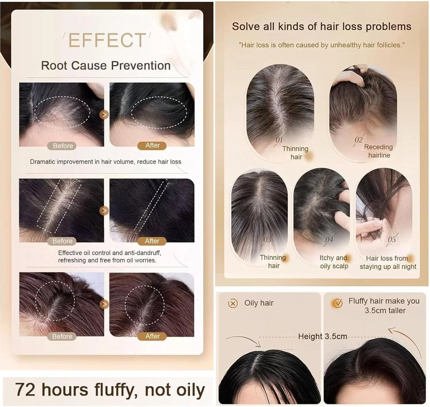 شامپو ضد ریزش مو Identicalven، شامپو مو ضد ریزش مو با عصاره گیاه زنجبیل، شامپو ضد شوره سر کنترل کننده چربی Polygonum Multiflorum، شامپو زنجبیل کنترل کننده چربی، عصاره های گیاهی طبیعی (2 عدد) شامپو ضد ریزش مو Identicalven، شامپو مو ضد ریزش مو با عصاره گیاه زنجبیل، شامپو ضد شوره سر کنترل کننده چربی Polygonum Multiflorum، شامپو زنجبیل کنترل کننده چربی، عصاره های گیاهی طبیعی (2 عدد)