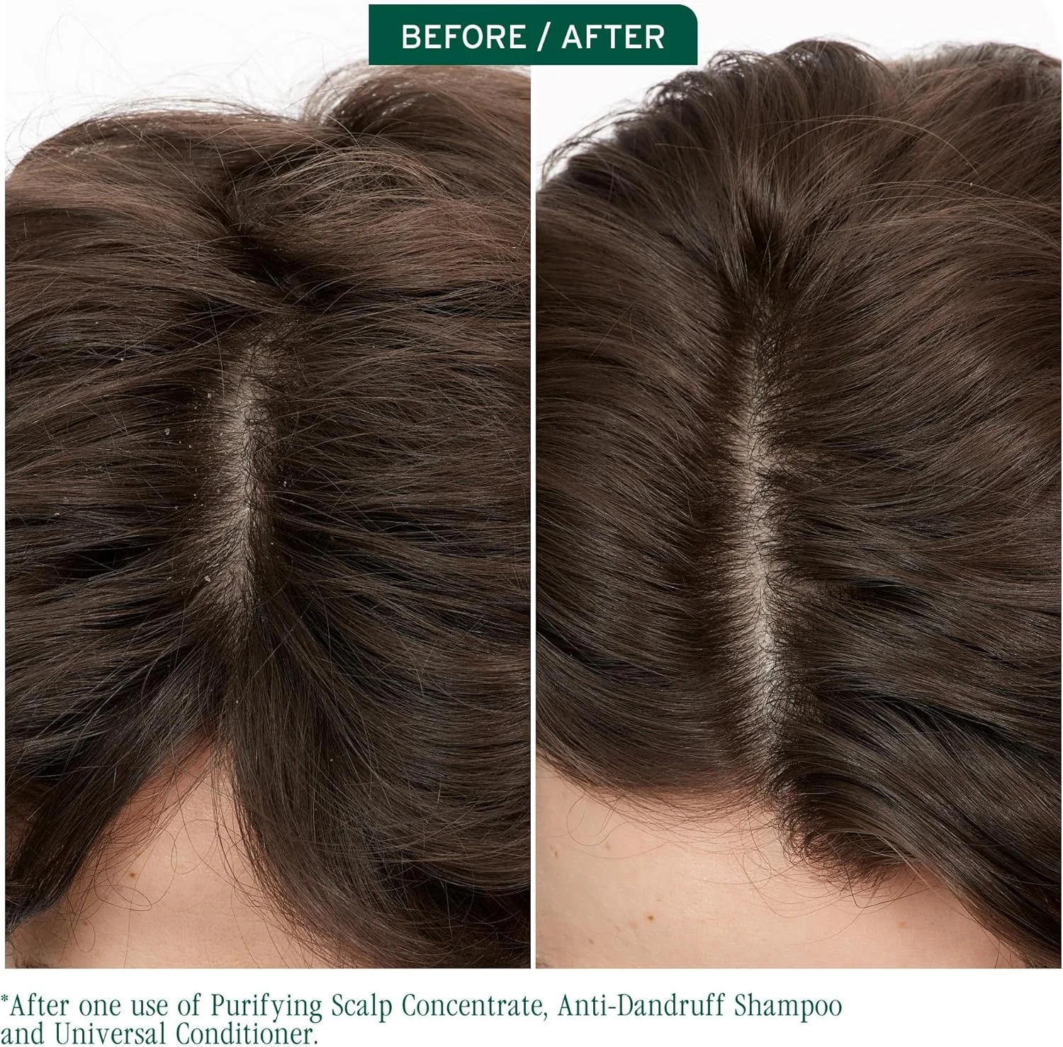 شامپو ضد شوره سر Biolage Scalp Sync | هدف قرار دادن شوره سر، کنترل ظاهر پوسته ها و تسکین تحریک پوست سر | فاقد پارابن | برای کنترل شوره سر | وگان | شامپو سالنی ضد شوره شامپو ضد شوره سر Biolage Scalp Sync | هدف قرار دادن شوره سر، کنترل ظاهر پوسته ها و تسکین تحریک پوست سر | فاقد پارابن | برای کنترل شوره سر | وگان | شامپو سالنی ضد شوره