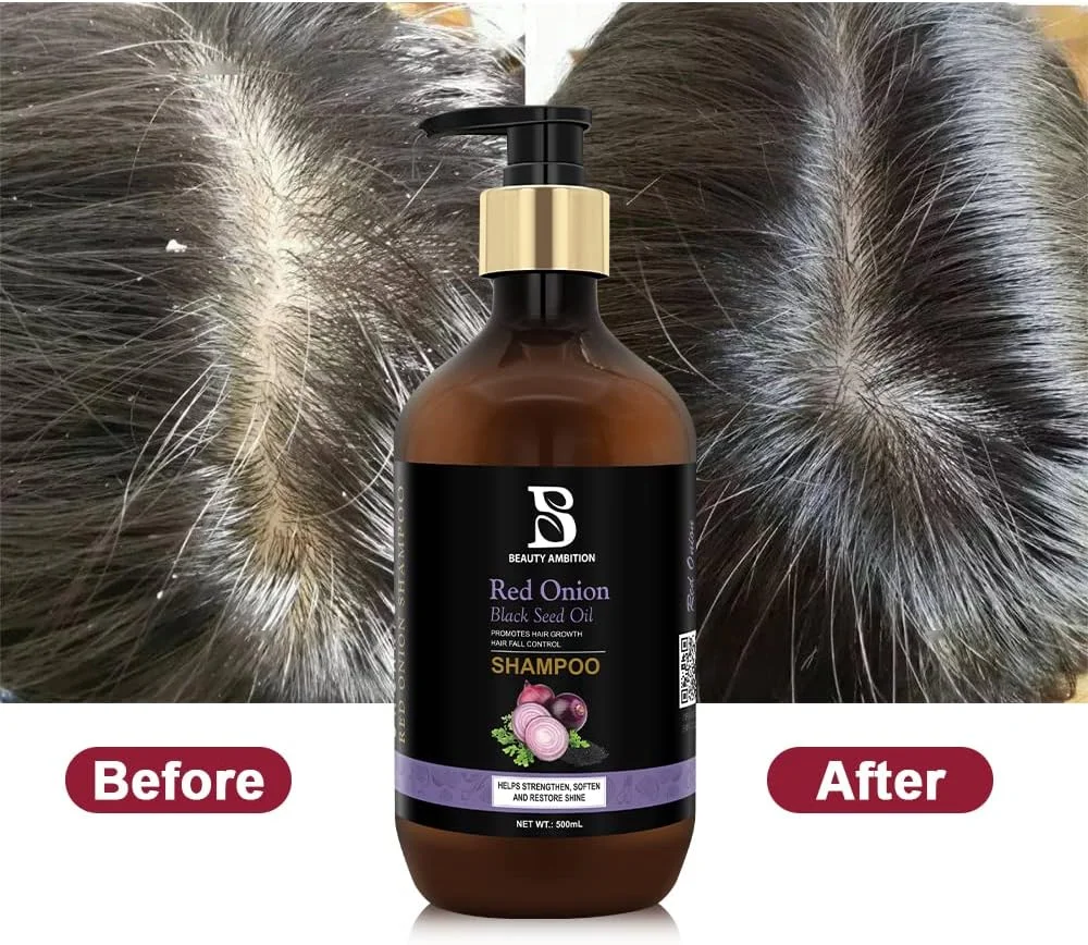 شامپو مو پیاز قرمز و روغن دانه سیاه احیا کننده BEAUTY AMBITION برای موهای قوی، سالم و بدون شوره - 500 میلی لیتر شامپو مو پیاز قرمز و روغن دانه سیاه احیا کننده BEAUTY AMBITION برای موهای قوی، سالم و بدون شوره - 500 میلی لیتر