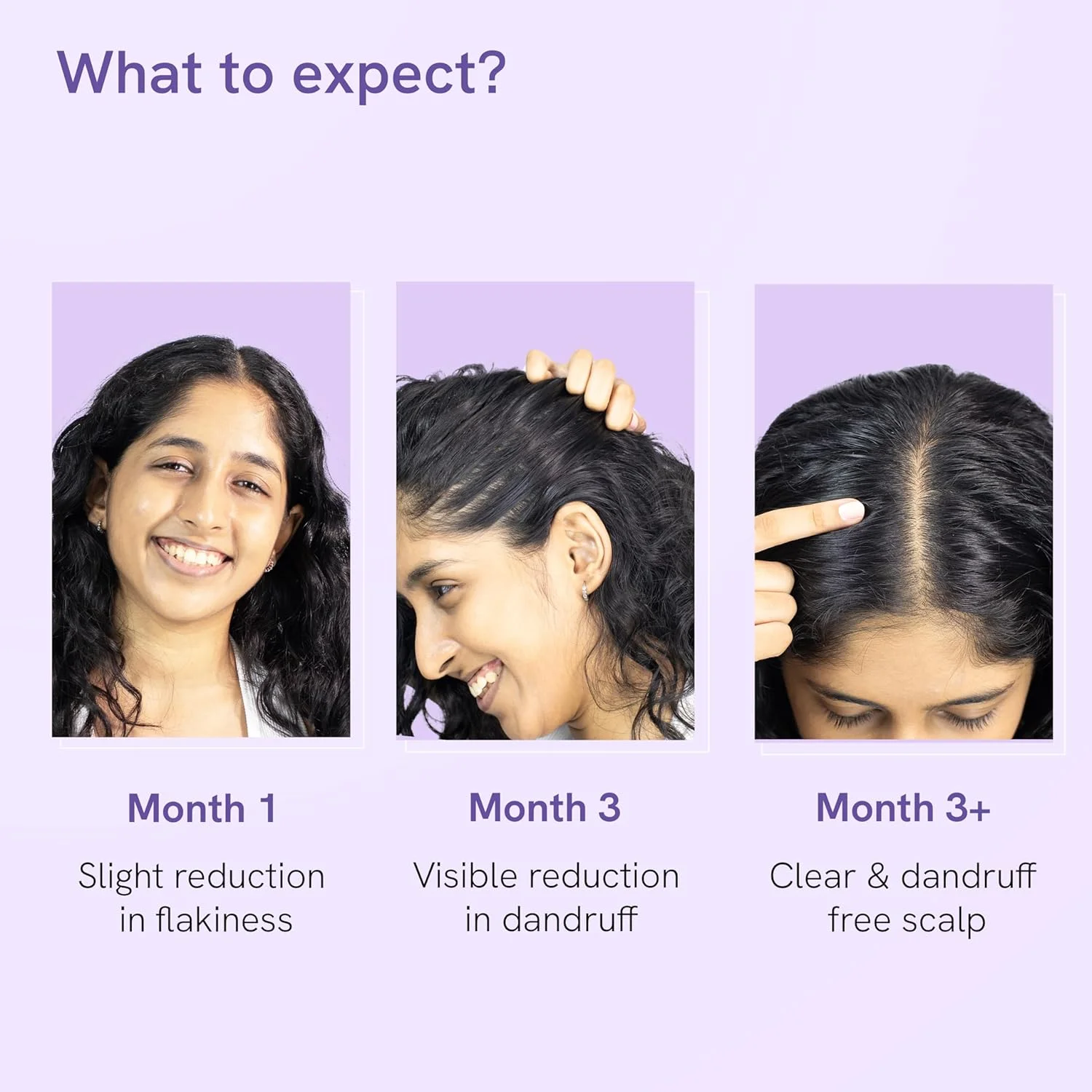 شامپو ضد شوره بی بادی وایز (150 میلی لیتر) و درمان رفع شوره سر قوی (60 میلی لیتر) مخصوص بانوان | هدف قرار دادن شوره سر و از بین بردن پوسته های قابل مشاهده | فاقد SLS و پارابن