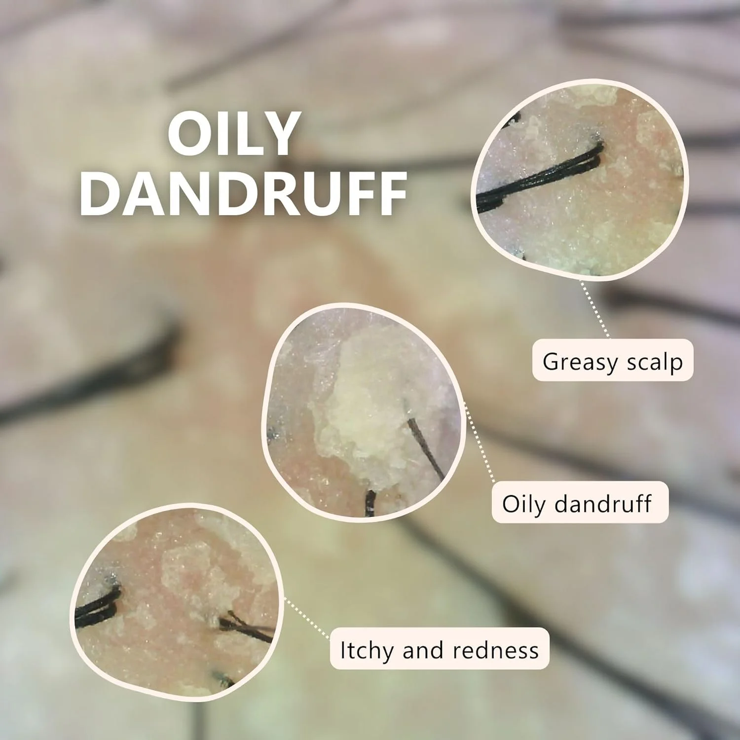 شامپو متعادل کننده پوست سر چرب AROMASE (ایده آل برای پوست سر چرب و دارای شوره) ۴۰۰ میلی لیتر شامپو متعادل کننده پوست سر چرب AROMASE (ایده آل برای پوست سر چرب و دارای شوره) ۴۰۰ میلی لیتر