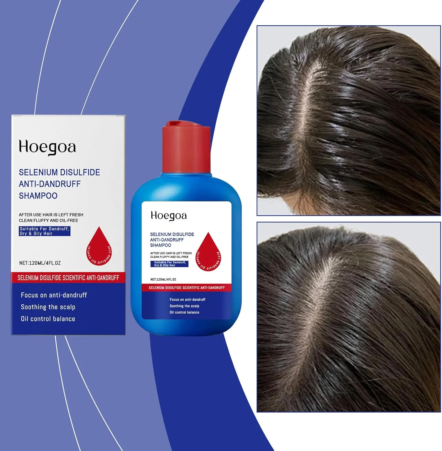 شامپو ضد شوره کنترل کننده چربی، پوست سر را عمیقا پاکسازی می کند، تجمع چربی را از بین می برد، موها را شاداب می کند، چربی را متعادل می کند و از ایجاد شوره جلوگیری می کند. ایده آل برای مراقبت روزانه مو برای آقایان و بانوان شامپو ضد شوره کنترل کننده چربی، پوست سر را عمیقا پاکسازی می کند، تجمع چربی را از بین می برد، موها را شاداب می کند، چربی را متعادل می کند و از ایجاد شوره جلوگیری می کند. ایده آل برای مراقبت روزانه مو برای آقایان و بانوان