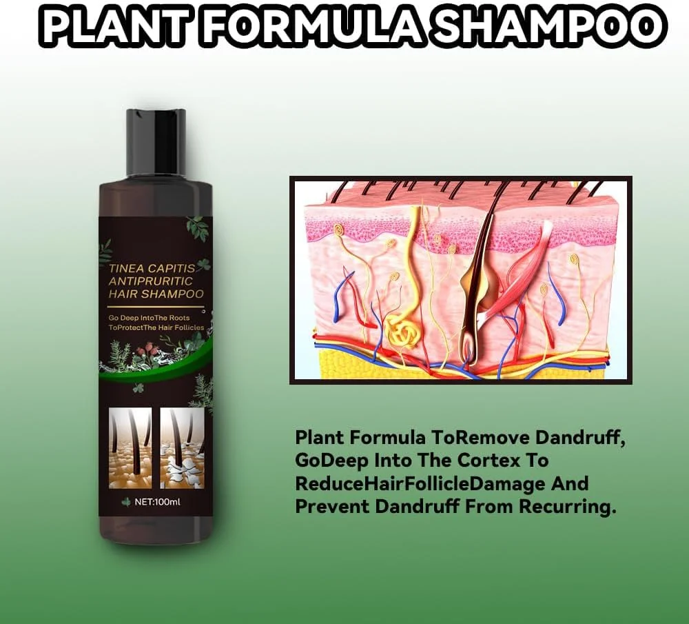 شامپو ضد شوره و ضد خارش، پاک کننده عمیق پوست سر برای پوست سر خشک و خارش دار و تسکین فولیکولیت مو، کاهش بار پوست سر و ترویج موهای سالم و راحت (2 عدد) شامپو ضد شوره و ضد خارش، پاک کننده عمیق پوست سر برای پوست سر خشک و خارش دار و تسکین فولیکولیت مو، کاهش بار پوست سر و ترویج موهای سالم و راحت (2 عدد)