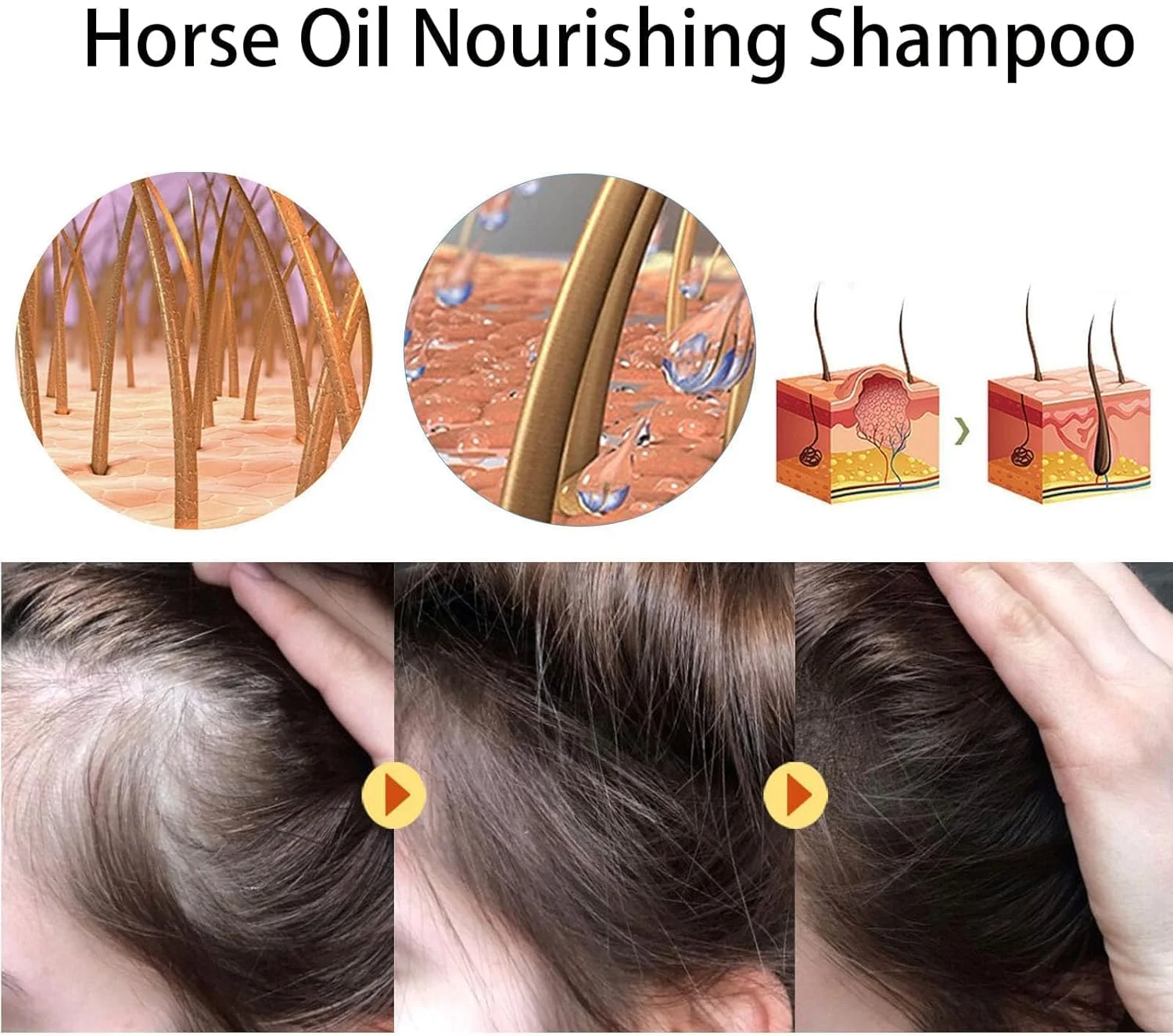 شامپو تقویت کننده مو و ضد ریزش مو TaboSi، شامپو مغذی Yaopin، شامپو زنجبیلی ضد نازک شدن مو، شامپو زنجبیلی ضد نازک شدن مو، موهای ضخیم و صاف برای انواع مو (1 عدد)