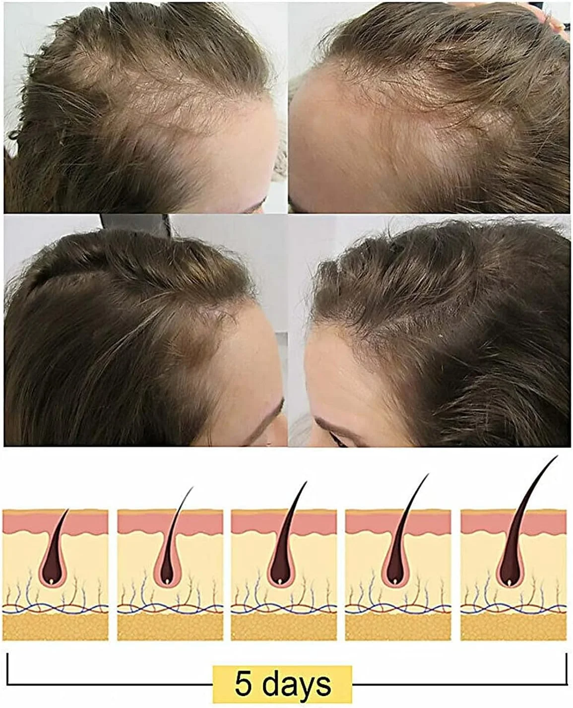 شامپو صابونی برنج، شامپو آب برنج تخمیر شده 2 در 1 برای رشد مو، نوار شامپو مرطوب کننده، ضد ریزش مو و ترمیم موهای خشک و آسیب دیده (1 عدد)
