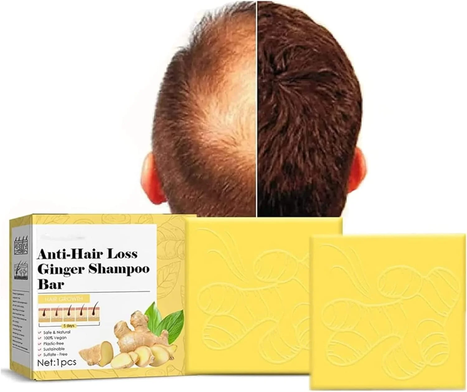 صابون شامپو زنجبیل، شامپو بار رشد مو، شامپو بار ضد ریزش مو، شامپو مراقبت از مو زنجبیل به توقف ریزش مو کمک می کند، باعث ضخیم تر و سریعتر شدن رشد مو می شود (2 عدد)