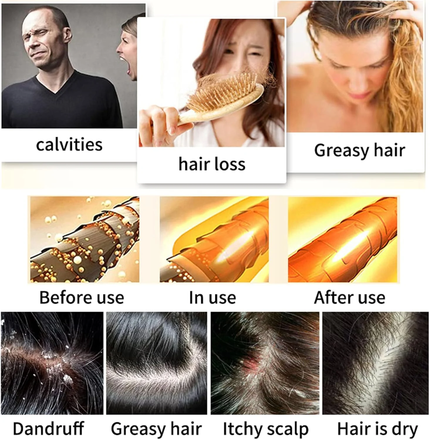 شامپو بار رزماری برای رشد مجدد مو CONTEK، شامپو بار پاک کننده عمیق برای مو و پوست سر، ضد ریزش مو، صابون شامپو رزماری طبیعی ارگانیک کنترل کننده چربی، بدون تست حیوانی و بدون روغن سیلیکون (رزماری)