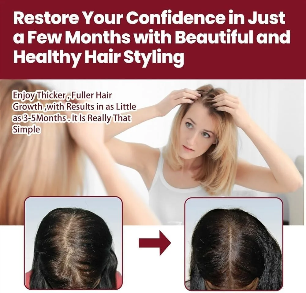 شامپو فوم بازسازی مو، شامپو بیوتین و کلاژن برای رشد مو، موهای خود را متحول کنید: راه حل های ثابت شده برای رشد مجدد مو. مناسب برای انواع مو (رنگ: 2 عدد (بسته 2 عددی)) شامپو فوم بازسازی مو، شامپو بیوتین و کلاژن برای رشد مو، موهای خود را متحول کنید: راه حل های ثابت شده برای رشد مجدد مو. مناسب برای انواع مو (رنگ: 2 عدد (بسته 2 عددی))