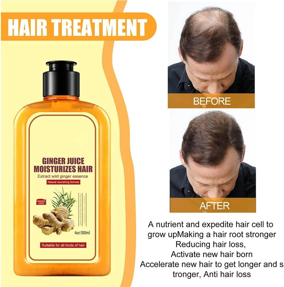 شامپو ضد ریزش و تقویت کننده مو زنجبیلی PuraGinger PRO HairReborn، آب زنجبیل مرطوب کننده مو، شامپو مراقبت از مو زنجبیلی، شامپو زنجبیلی برای رشد مو (5 عدد) شامپو ضد ریزش و تقویت کننده مو زنجبیلی PuraGinger PRO HairReborn، آب زنجبیل مرطوب کننده مو، شامپو مراقبت از مو زنجبیلی، شامپو زنجبیلی برای رشد مو (5 عدد)