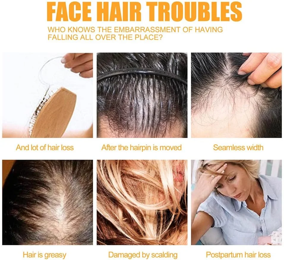 شامپو ضد ریزش و تقویت کننده مو زنجبیلی PuraGinger PRO HairReborn، آب زنجبیل مرطوب کننده مو، شامپو مراقبت از مو زنجبیلی، شامپو زنجبیلی برای رشد مو (5 عدد) شامپو ضد ریزش و تقویت کننده مو زنجبیلی PuraGinger PRO HairReborn، آب زنجبیل مرطوب کننده مو، شامپو مراقبت از مو زنجبیلی، شامپو زنجبیلی برای رشد مو (5 عدد)