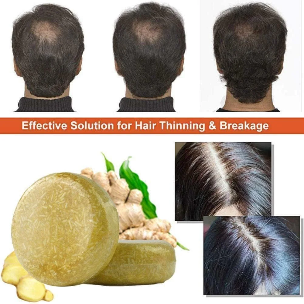 شامپو زنجبیل ارگانیک، صابون شامپو ضد ریزش مو، صابون مراقبت از رشد مو، شامپو بار جامد، شامپو بار طبیعی برای مو، نرم کننده ارگانیک و صابون ترمیم کننده برای موهای خشک و آسیب دیده (2 عدد) شامپو زنجبیل ارگانیک، صابون شامپو ضد ریزش مو، صابون مراقبت از رشد مو، شامپو بار جامد، شامپو بار طبیعی برای مو، نرم کننده ارگانیک و صابون ترمیم کننده برای موهای خشک و آسیب دیده (2 عدد)