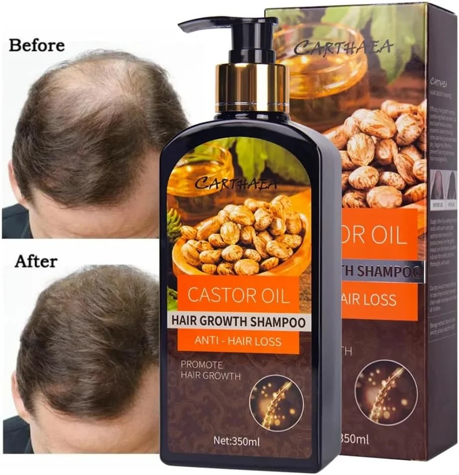 شامپو روغن کرچک نیکیتیا ویوی برای رشد مو 350 میلی لیتر، شامپو روغن کرچک برای موهای خشک و آسیب دیده، رشد مو و افزایش ضخامت، شامپو ضد ریزش مو، تقویت کننده و آبرسان و جلوگیری از شکستگی مو شامپو روغن کرچک نیکیتیا ویوی برای رشد مو 350 میلی لیتر، شامپو روغن کرچک برای موهای خشک و آسیب دیده، رشد مو و افزایش ضخامت، شامپو ضد ریزش مو، تقویت کننده و آبرسان و جلوگیری از شکستگی مو