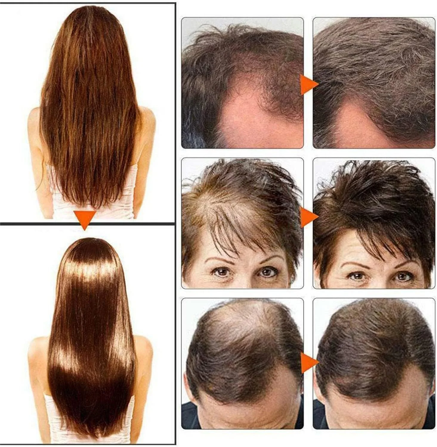 شامپو بار طبیعی 100% برای مو، صابون شامپو زنجبیلی، شامپو بار رشد مو، شامپو بار زنجبیلی ارگانیک، صابون مراقبت از رشد مو و ضد ریزش مو (1 عدد) شامپو بار طبیعی 100% برای مو، صابون شامپو زنجبیلی، شامپو بار رشد مو، شامپو بار زنجبیلی ارگانیک، صابون مراقبت از رشد مو و ضد ریزش مو (1 عدد)