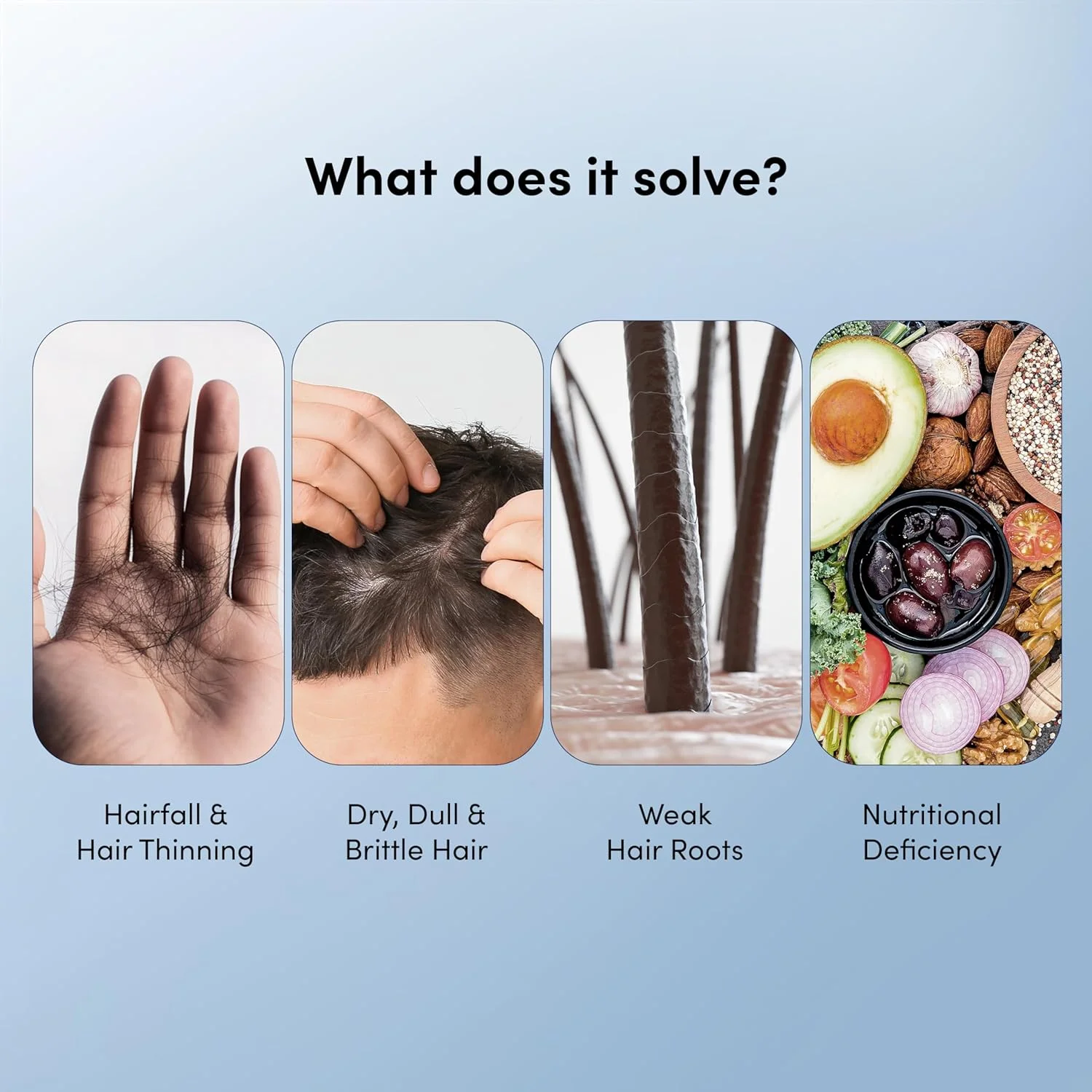 پاستیل مو بیوتین من ماتررز 30 عددی و شامپو ضد ریزش مو DHT 200 میلی لیتر | مسدود کننده های DHT با بیوتین، کافئین و روی | کیت ریزش مو مرحله 1 | تقویت کننده مو و کاهش دهنده ریزش مو