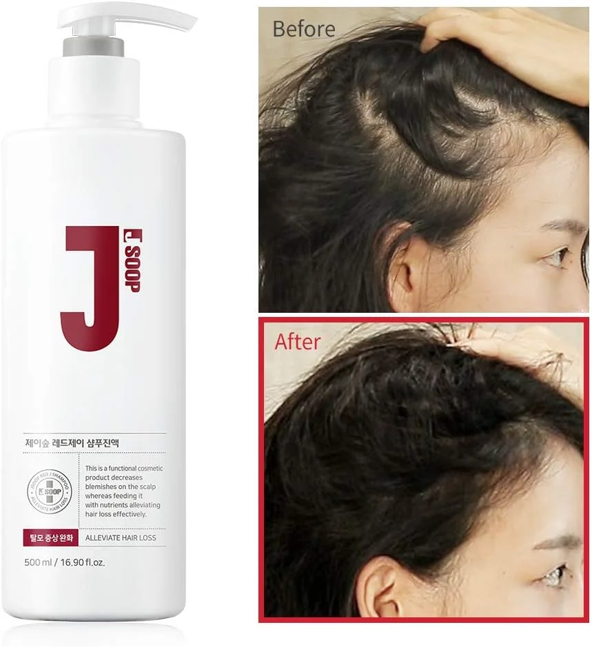 شامپو قرمز جِی سوپ 500 میلی لیتر / ضد ریزش مو، تحریک کم پوست، کاهش قرمزی پوست سر