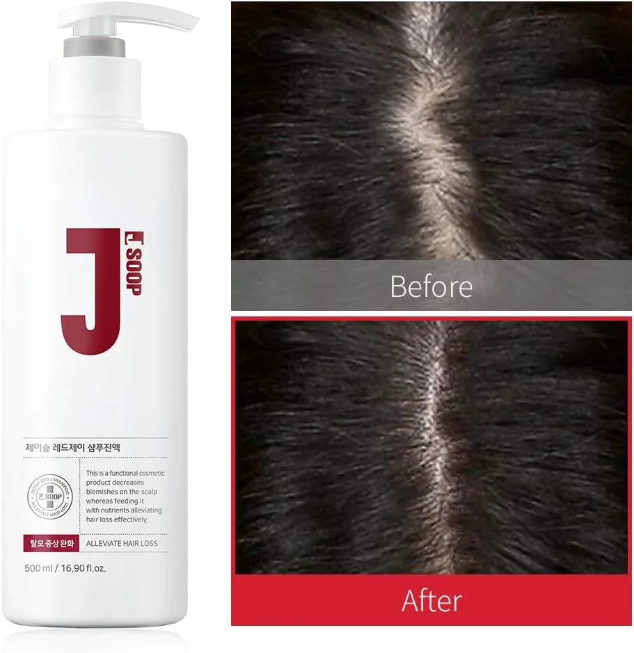 شامپو قرمز جِی سوپ 500 میلی لیتر / ضد ریزش مو، تحریک کم پوست، کاهش قرمزی پوست سر