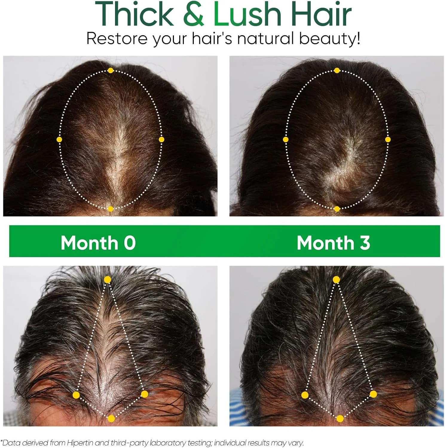 شامپو تقویت کننده و جلوگیری از ریزش مو Hipertin با کاپیلیالونگا و عصاره گوارانا، مواد طبیعی برای موهای نازک، روتین ضد ریزش مو، مناسب برای آقایان و بانوان، 300 میلی لیتر شامپو تقویت کننده و جلوگیری از ریزش مو Hipertin با کاپیلیالونگا و عصاره گوارانا، مواد طبیعی برای موهای نازک، روتین ضد ریزش مو، مناسب برای آقایان و بانوان، 300 میلی لیتر