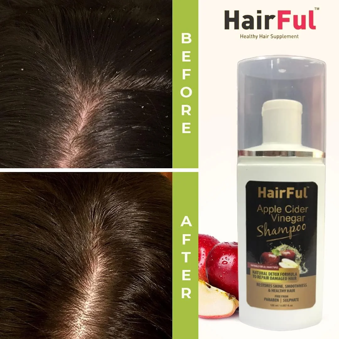 مجموعه دو کیت مراقبت از مو HairFul برای کنترل ریزش مو (شامپو مو 1 عدد + 10 عدد قرص HairFul)