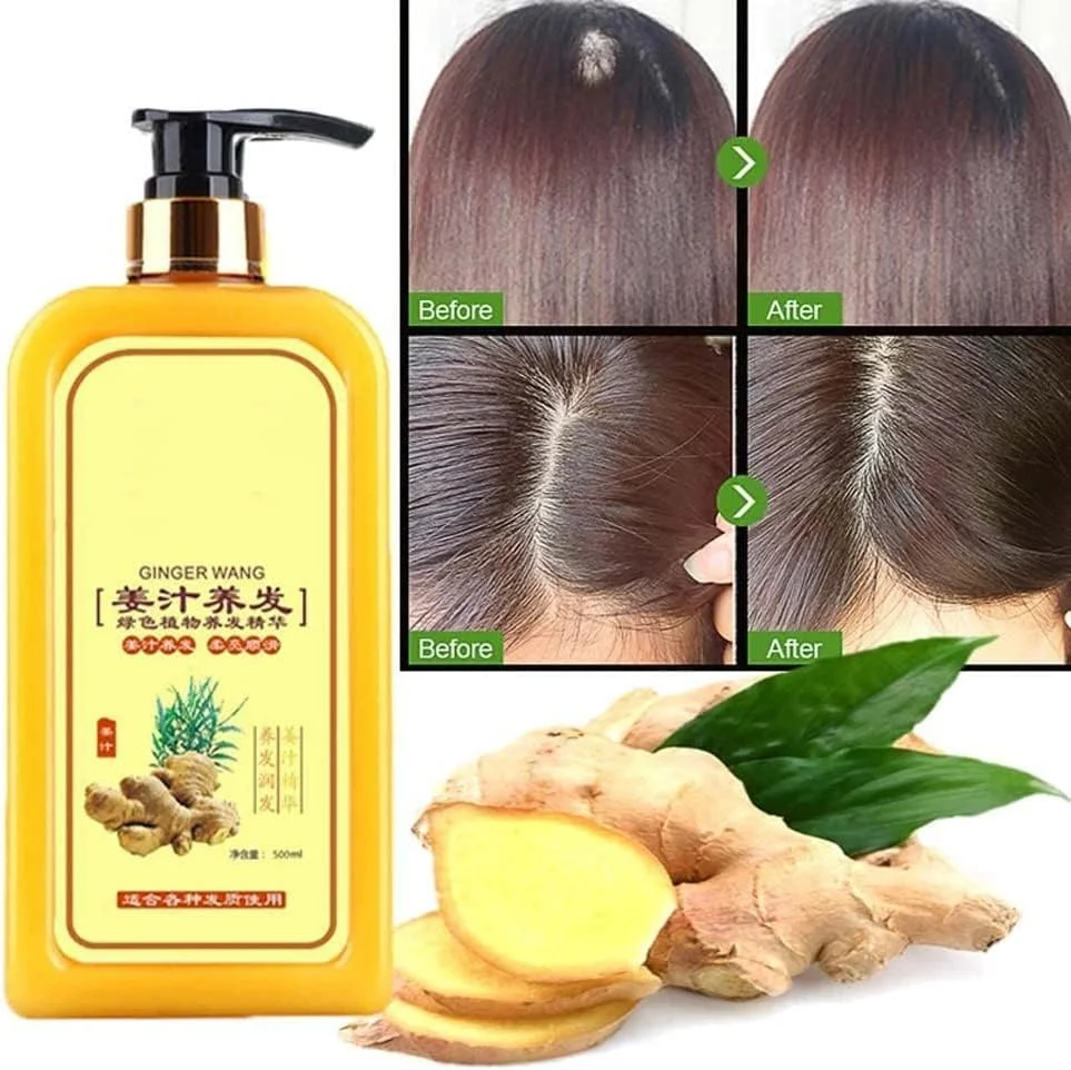 شامپو زنجبیل برای رشد مجدد مو، شامپو زنجبیل برای رشد مو، شامپو ضد ریزش مو، شامپو مراقبت از مو زنجبیل برای موهای نازک و ریزش مو، مناسب برای انواع مو
