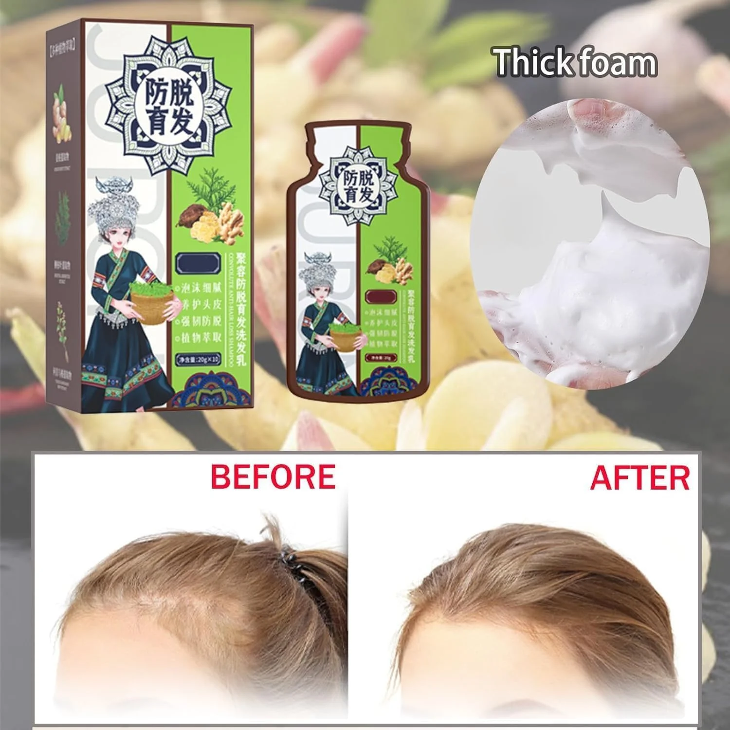 شامپو ضد ریزش مو با عصاره گیاه زنجبیل - شامپو تقویت کننده و ضد ریزش مو، شامپو زنجبیل با عصاره گیاهی، شامپو زنجبیل ارگانیک طبیعی برای آقایان و بانوان (2 بسته)