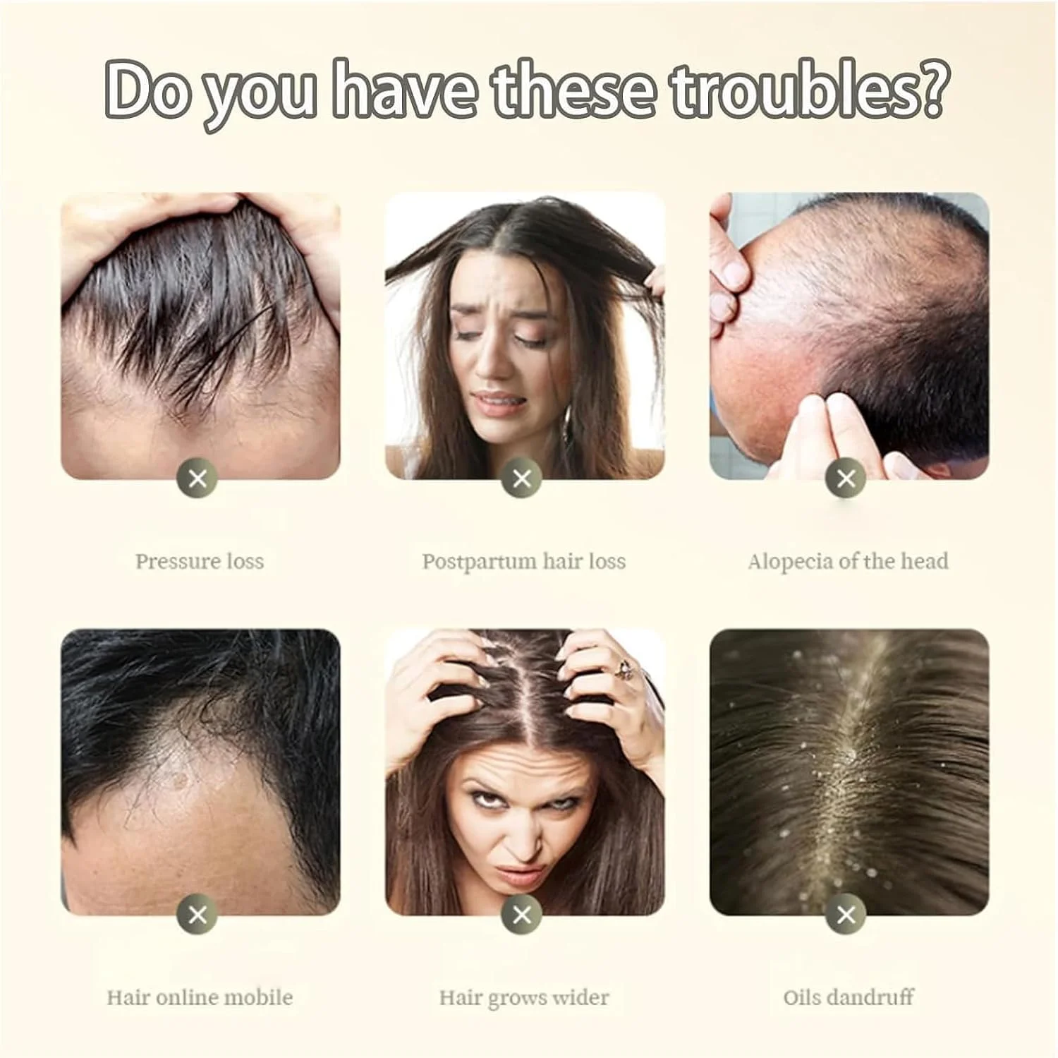 شامپو ضد ریزش مو حاوی عصاره گیاه زنجبیل GIONAR، شامپو ضد ریزش و تقویت کننده مو، شامپو عصاره گیاه زنجبیل، شامپو ضد ریزش مو حاوی عصاره گیاهی برای زنان و مردان (5 عدد)