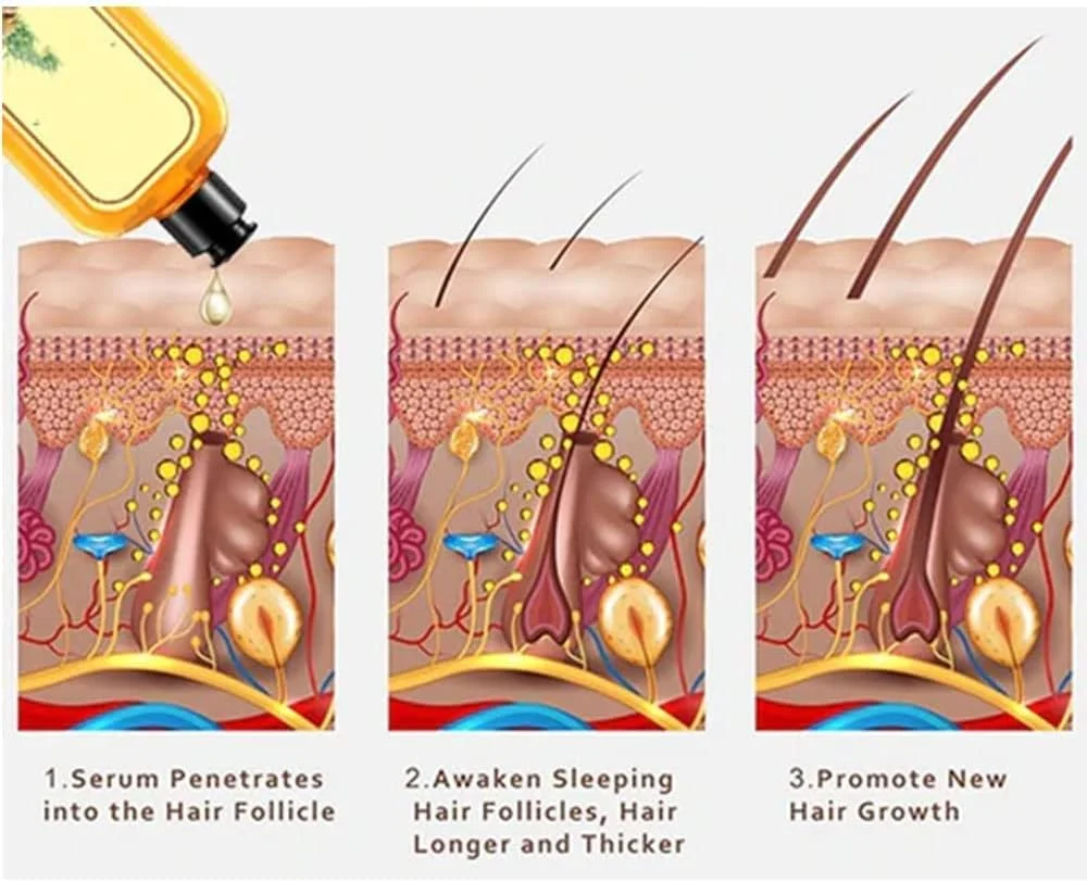 شامپو زنجبیل فوری Ginaday برای رشد مجدد مو، شامپو زنجبیل برای رشد مو، شامپو مراقبت از مو زنجبیل، شامپو ضد ریزش مو زنجبیل (500 میلی لیتر، 1 عدد)