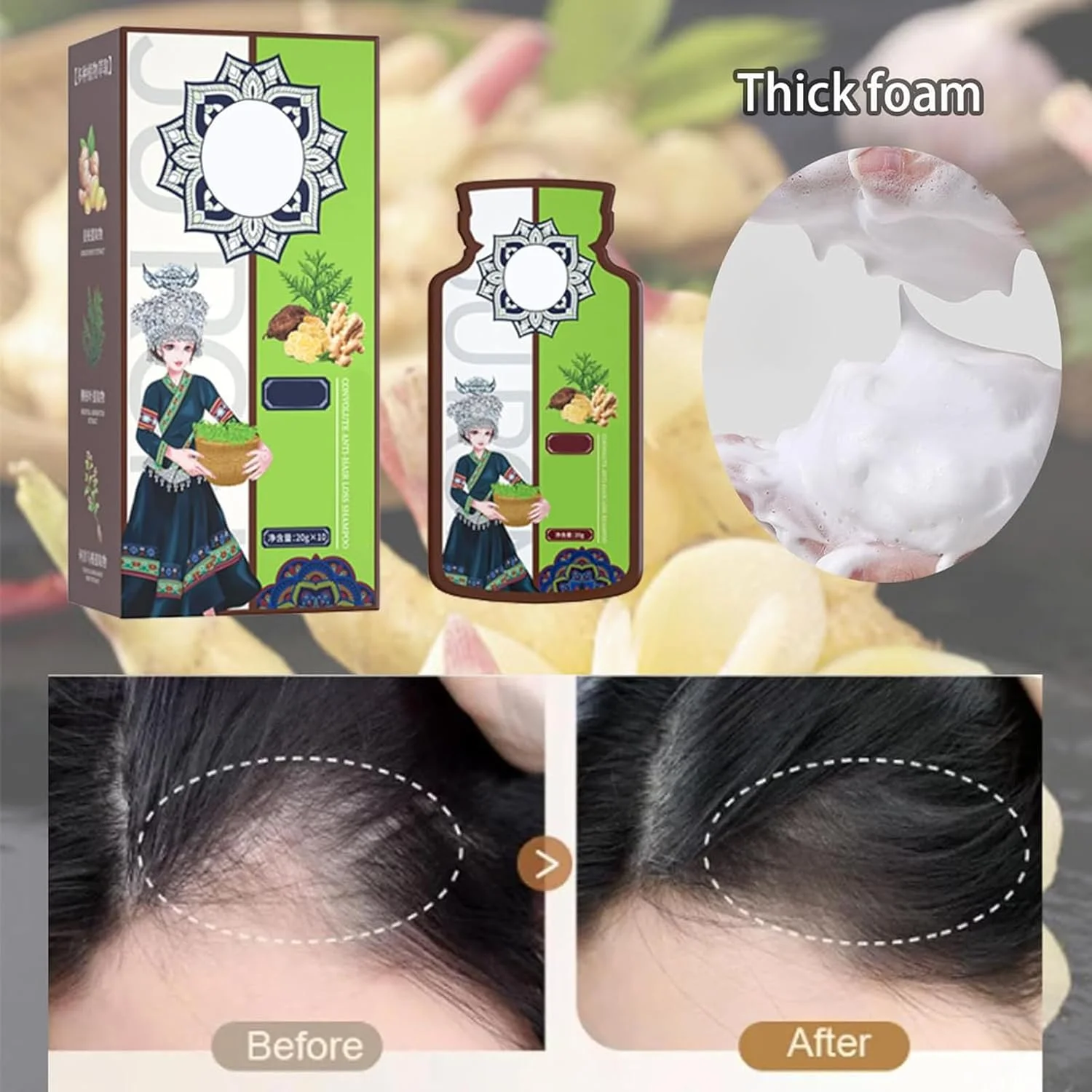 شامپو ضد ریزش مو با عصاره گیاه زنجبیل، شامپو رشد مو با عصاره گیاه زنجبیل، شامپو فعال کننده ریشه مو، شامپو ضد ریزش مو زنجبیل، شامپو عصاره گیاهی (3 جعبه) شامپو ضد ریزش مو با عصاره گیاه زنجبیل، شامپو رشد مو با عصاره گیاه زنجبیل، شامپو فعال کننده ریشه مو، شامپو ضد ریزش مو زنجبیل، شامپو عصاره گیاهی (3 جعبه)