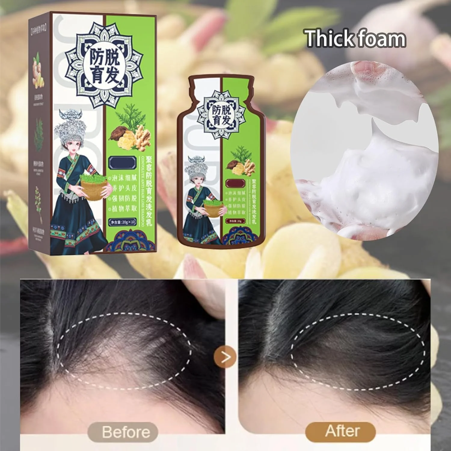 شامپو ضد ریزش مو با عصاره گیاه زنجبیل، شامپو عصاره گیاه زنجبیل (200 میلی لیتر - 3 عدد)